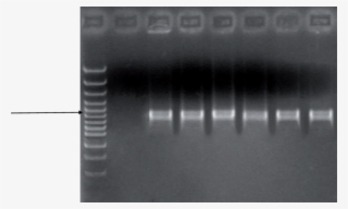 Detection Of X #6893227