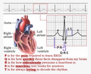 24hr Holter Monitor - 12 Lead Ekg: The Flash Card Book [book] #691215