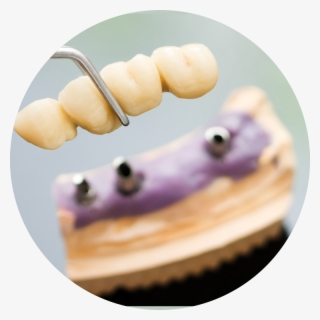 The Surrounding Teeth Deteriorate And It Is Just A #6904052