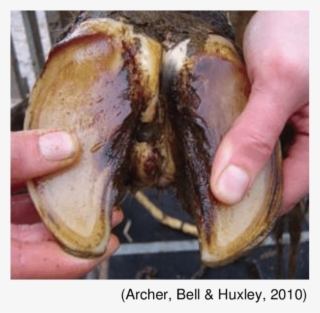 An Acute Bacterial Infection Of The Subcutaneous Tissues #6909219