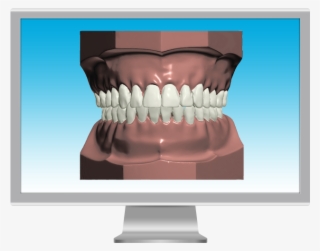 Digital Model Screen #6950297