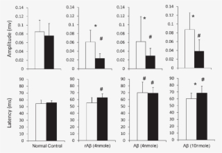 Vep Amplitude And Latency Of Left And Right Eyes (black #6980471