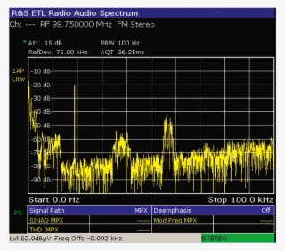Etl Tv Analyzer #6985766