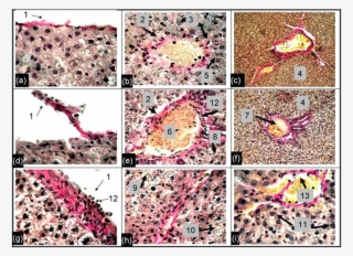 Photomicrographs Liver Preparations Control (c)) And #7094678
