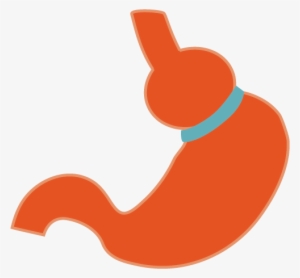 Laparoscopic Adjustable Gastric Band Is A Type Of Weight - Adjustable Gastric Band #710452