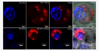 Subcellular Localization Of Hk #7162502