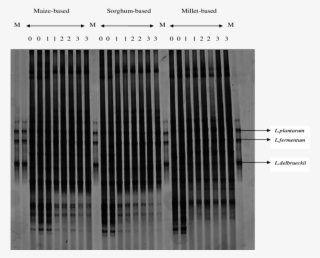 Dgge Analysis Of Pcr-amplified 16s Rdna Fragment For #7218890