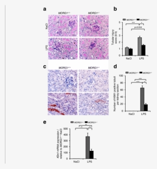 Analysis Of Renal Damage #7341778