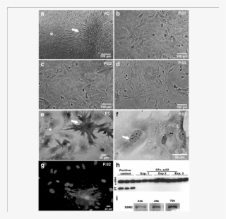 A-f Phase Contrast And Bright Field Microscopy Showing #7367539