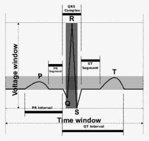 Typical Surface Ecg Signal Heart Beat - Heart Rate #746121