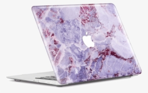 Macbook Pro 13 Inch Case And Keyboard Protector,xyx #748081