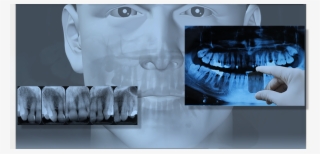 Dental X-ray #7439036