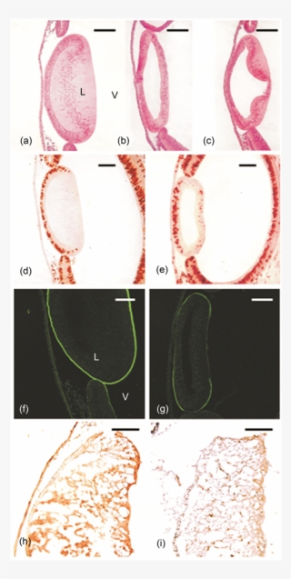 Micrographs Of Middle Sections Of Chick Lens Anlagen #7443637