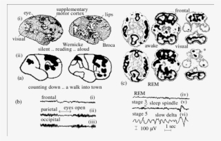 Silent Reading Is Contrasted With Reading Aloud, In #7450030