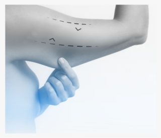 Levantamiento De Brazo #7458914