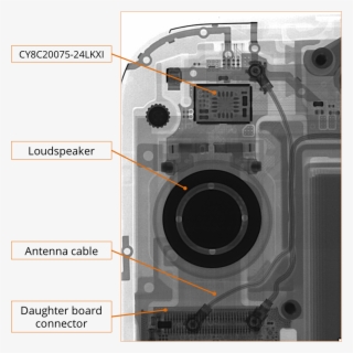 The Next Detail X Ray Image We Took Shows The Top Right #7463059 The Next Detail X Ray Image We Took Shows The Top Right #7463059