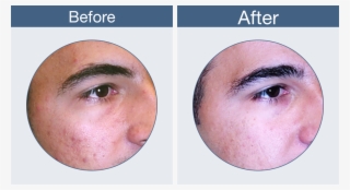 Clearogen Before & After #7470204