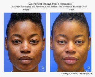 Before & After #7470263