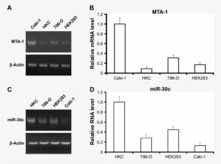Expression Of Mir 30c Is Inversely Associated With #7496640
