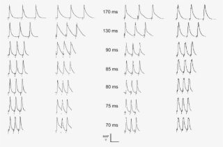 Epicardial Monophasic Action Potential Recordings Obtained #7576249