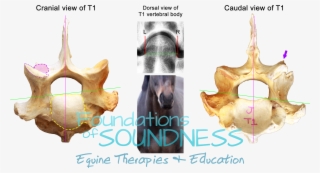 But The Most Interesting Revelation About The Dvl's - Medical Imaging #7615501