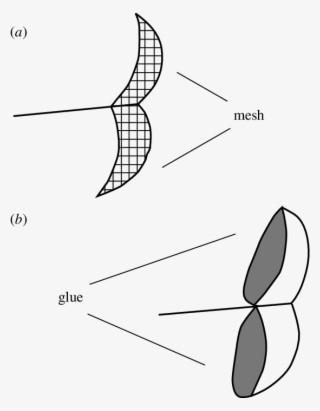 Closure By Application Of A Light Mesh Glued To The - Diagram #7618574