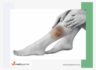 First Aid - Toe #7625297