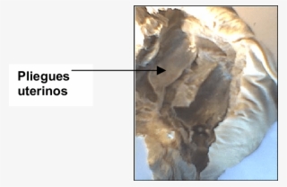 Cápsulas Uterinas Y Membrana Del Huevo O Tercer Membrana - Shell #7633152