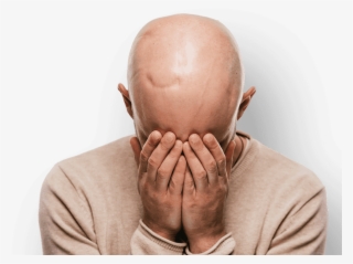 Man With Scarring On Head Holding Hands To Face - Cancer #7702719