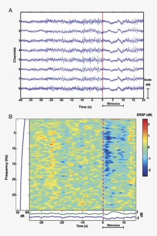 Desynchronization Of Eeg In Pigeons Caused By Stimulation - Plot #7741170 Desynchronization Of Eeg In Pigeons Caused By Stimulation - Plot #7741170