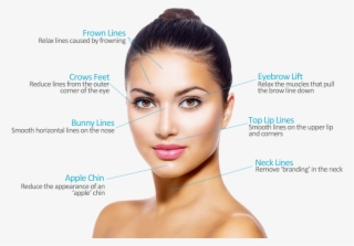 Botox Areas - Facial Aesthetics - Free Transparent PNG Download - PNGkey