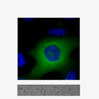 "gotas Líquidas " De Cpeb4en El Citoplasma Celular - Circle #7797180