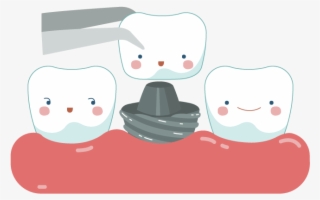 Dental Crowns & Bridges Sudbury Smiles Dentistry Picture - Dental Crown Cartoon #7813243