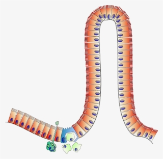 Celiac Disease - Enterocyte Cartoon #7838076