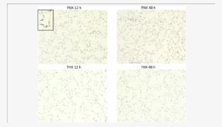 Representative Findings Of Immunohistochemistry For - Number #7857179