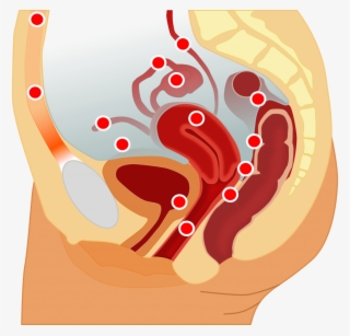 La Endometriosis Es Una Enfermedad, No Un Dolor De - Possible Locations Of Endometriosis #7871279