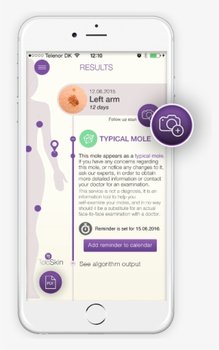 Go To Your Mole Diary, Click On The Image That You - Iphone #7877061