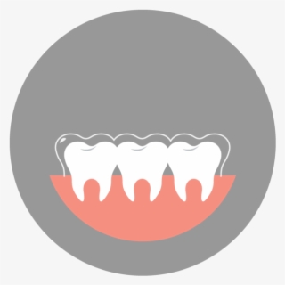 Invisalign-art - Illustration #7906605