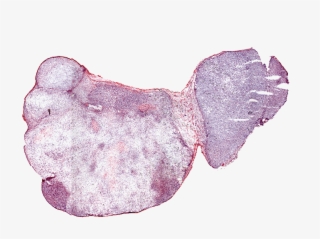 Visualization Of Th-302, A Cancer Therapeutic - Illustration #7914994