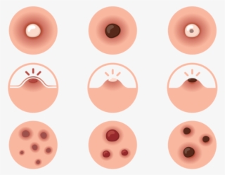 Pimple Png - Icon Anti Pimple #7932222
