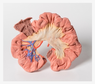 Skip To The End Of The Images Gallery - Diagram #7977631