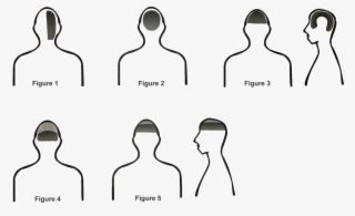 Headaches - Tight Band Feeling Around Head #8003024