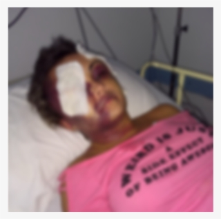 Mulher É Espancada Pelo Namorado Durante Estadia De - Girl #8151887