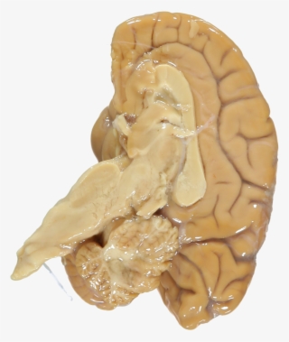 2009-01~processed - Western Gorilla Brain #8167324