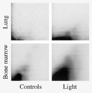 Examples Of Autoradiographic Patterns Of Dna Adducts - Monochrome #8197684