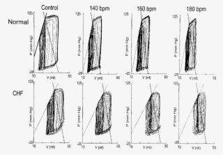Variably Loaded Pressure Volume Loops At Increasing - Sketch #8198078