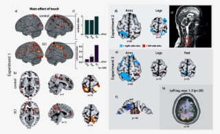 Both The Healthy Control And The Spinal Cord Injury - Illustration #8247522