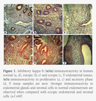 Inhibitory Kappa B Immunoreactivity In Human Normal - Visual Arts #8269861
