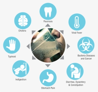 Acute Effects Occur Within Hours Or Days Of The Time - Graphic Design #8298032