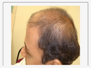Improved Hair Growth Within 4 Months After Changing - Girl #8306161